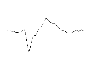 O1-Signal
