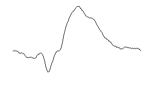 Pz-Signal